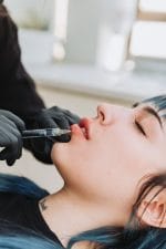 Relleno de Labios con Ácido Hialurónico