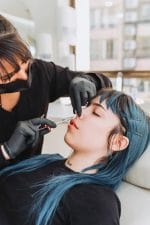 Relleno de Labios con Ácido Hialurónico - Imagen 13