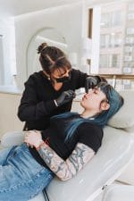 Relleno de Labios con Ácido Hialurónico - Imagen 16