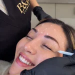 Toxina Butolínica Botox 3 zonas