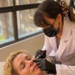 Relleno de Pómulos con Ácido Hialurónico