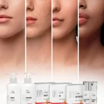 Despigmentante Meline®