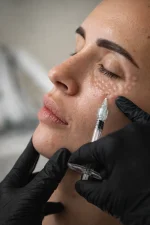 Skinbooster - Imagen 2