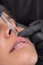 Armonización Facial - Plan personalizado según evaluación médica - Imagen 4