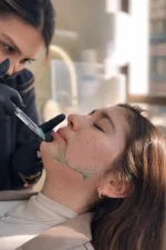 Mentomodelación y Contorno Mandibular con Ácido Hialurónico - Imagen 6