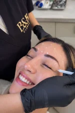 Toxina Botulínica (Botox)