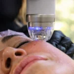 Radiofrecuencia Fraccionada  Endymed Pro Max – Intensif  Facial